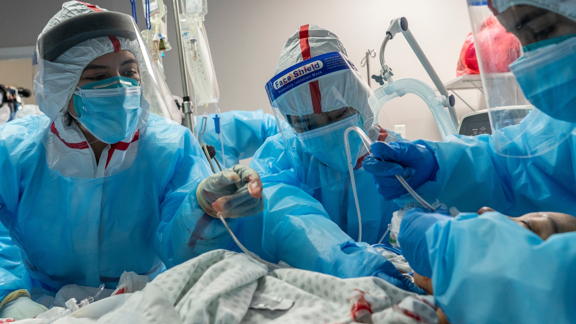 Paciente com Covid-19 é intubada em hospital do Texas, nos EUA