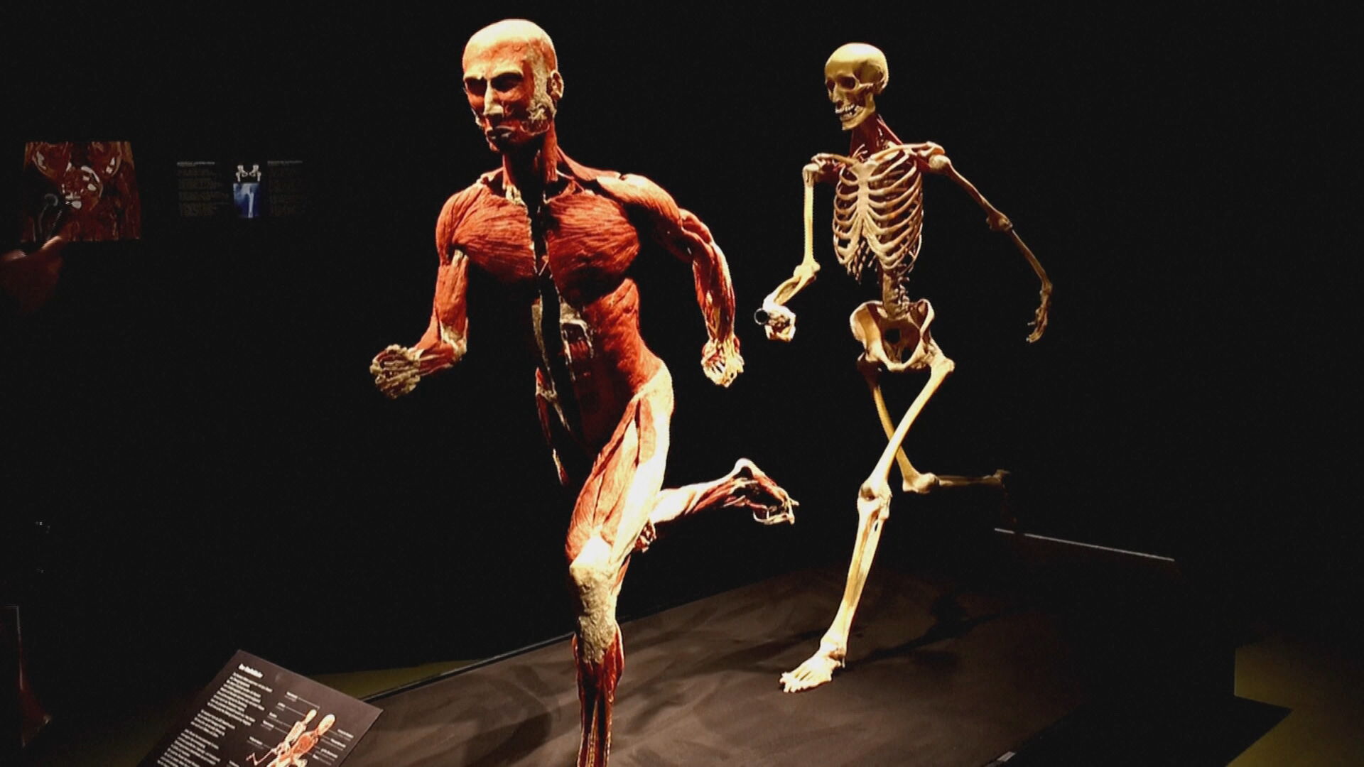 Exposição em Zurique usa cadáveres humanos reais