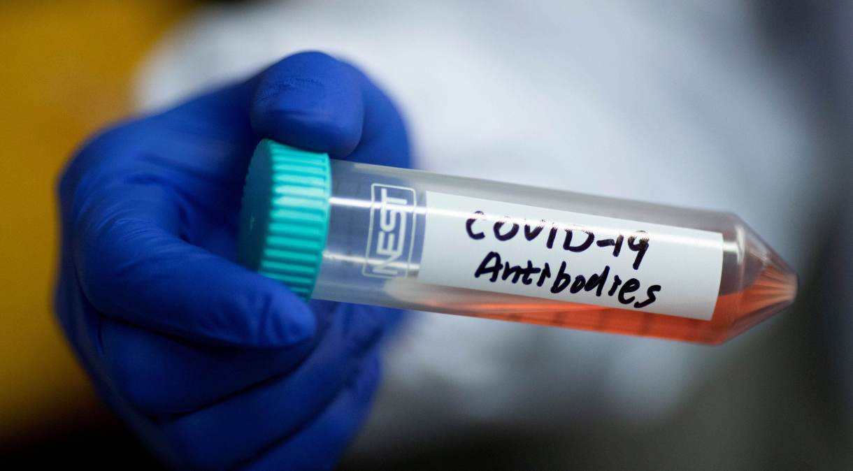 Tubo contendo anticorpos que podem ser usados em tratamento contra novo coronavírus em universidade em Pequim, China