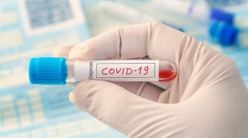 Autoridades sul-coreanas informaram nesta sexta-feira (10) que 91 pacientes que tiveram COVID-19 testaram positivo outra vez