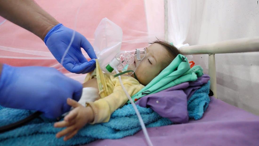 Hassan Ali, de dez meses, que morreu em um hospital em Abs, Iêmen, onde estava sendo tratado por desnutrição