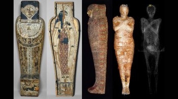 Pesquisadores encontraram pequeno pé no abdômen da múmia ao analisarem tomografia de corpo que, originalmente, acreditavam ser de um sacerdote 