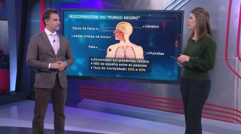 Neurocirurgião Fernando Gomes explica que indivíduos imunossuprimidos e com diabetes não controlada estão mais suscetíveis a desenvolver a mucormicose