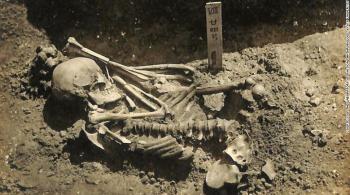 Especialistas de Oxford fizeram a descoberta enquanto estudavam os restos mortais de um homem adulto escavado perto do Mar Interior de Seto, no Japão