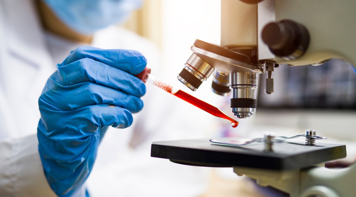 Teste de sangue poderá detectar cerca de 50 tipos de câncer