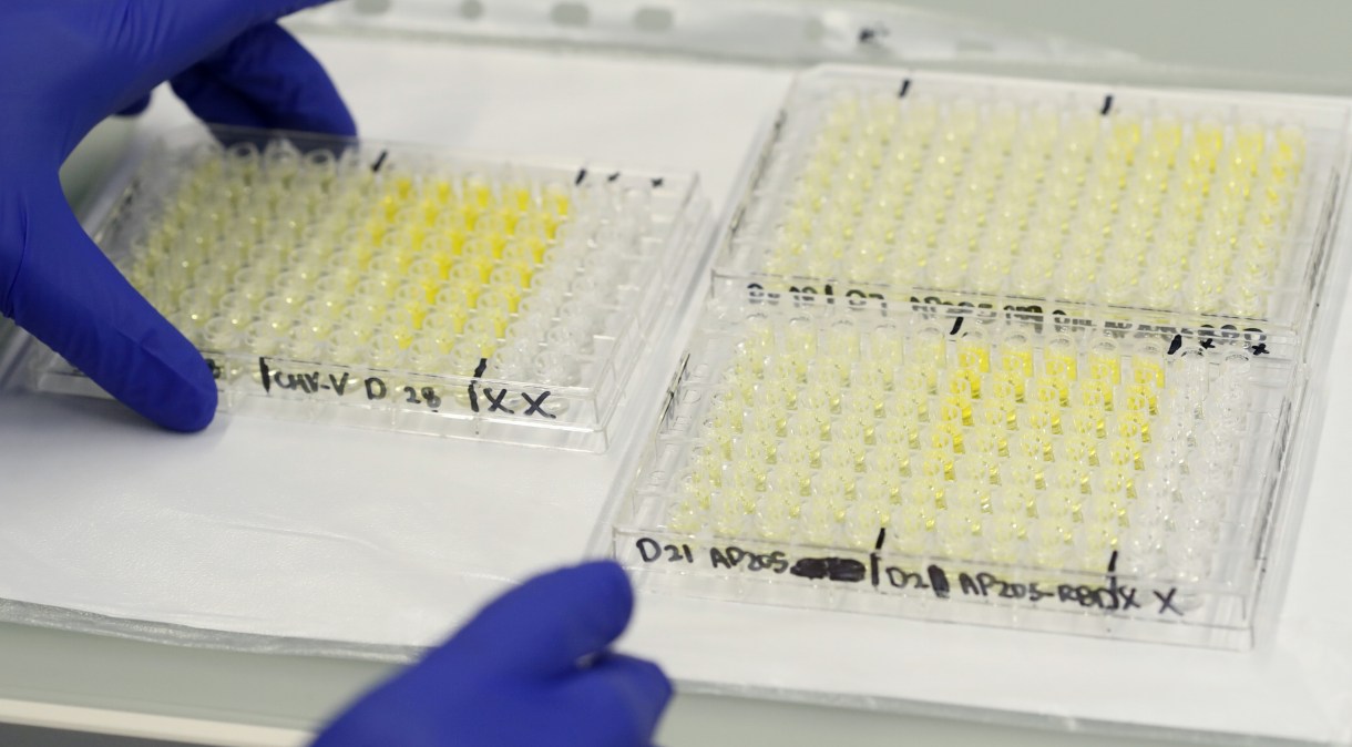 Amostras de exames para novo coronavírus em laboratório em Berna, na Suíça
