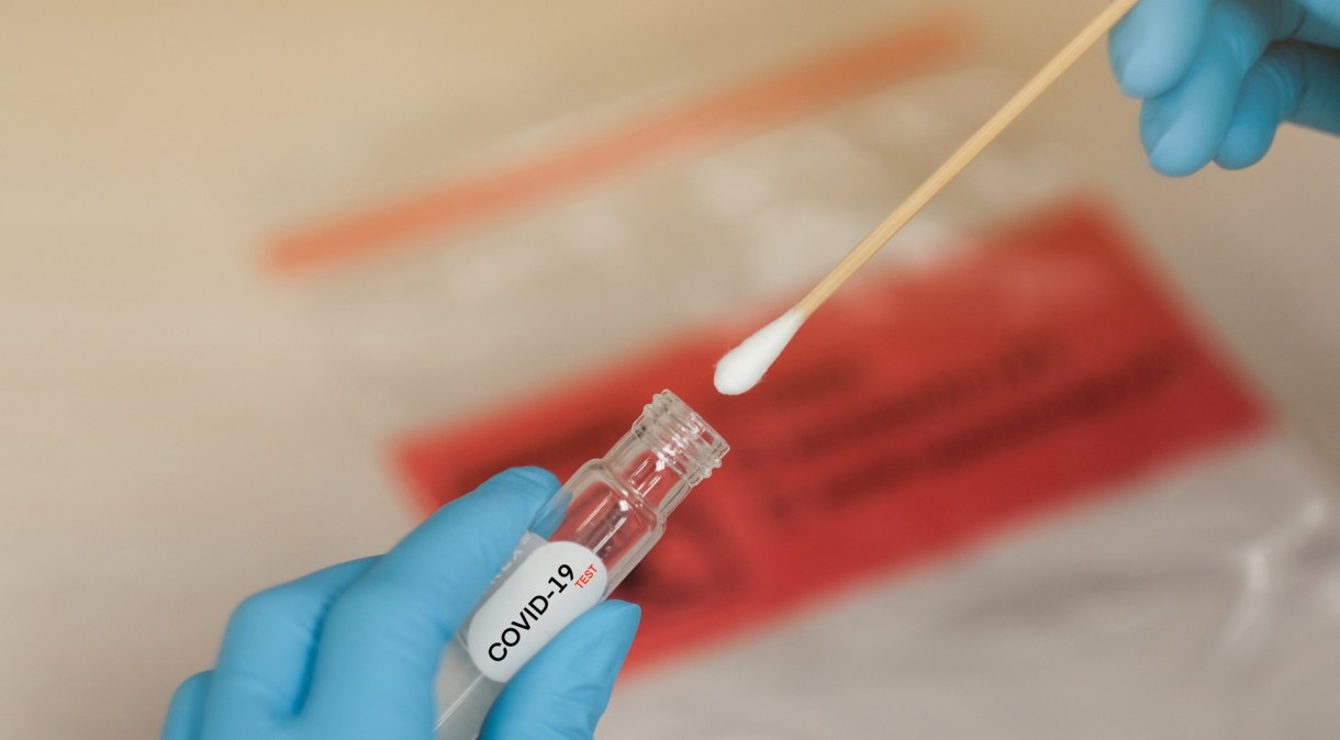 Teste laboratorial para identificar o coronavírus