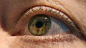 Estudo avaliou mais de 130 mil imagens retinais de banco britânico