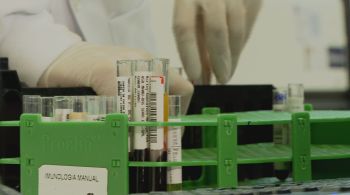 Presidente da Associação Brasileira de Medicina Diagnóstica afirma que os laboratórios têm capacidade para atender ao público nos exames para coronavírus
