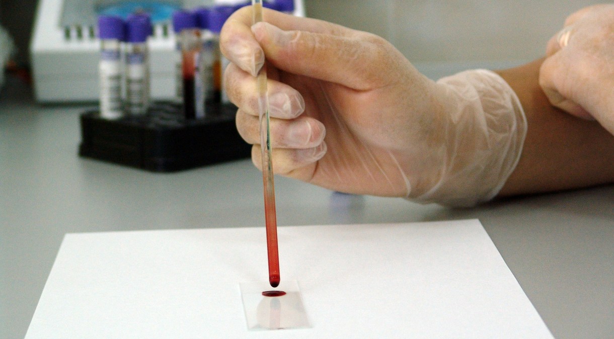 Pesquisa sobre a Covid-19 inicia fase de coleta de sangue de participantes selecionados para ajudar a entender a doença no Brasil