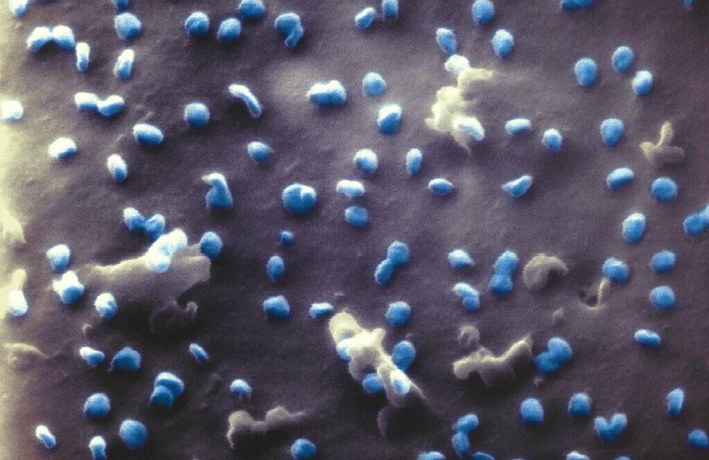 Novo coronavírus visto no microscópio