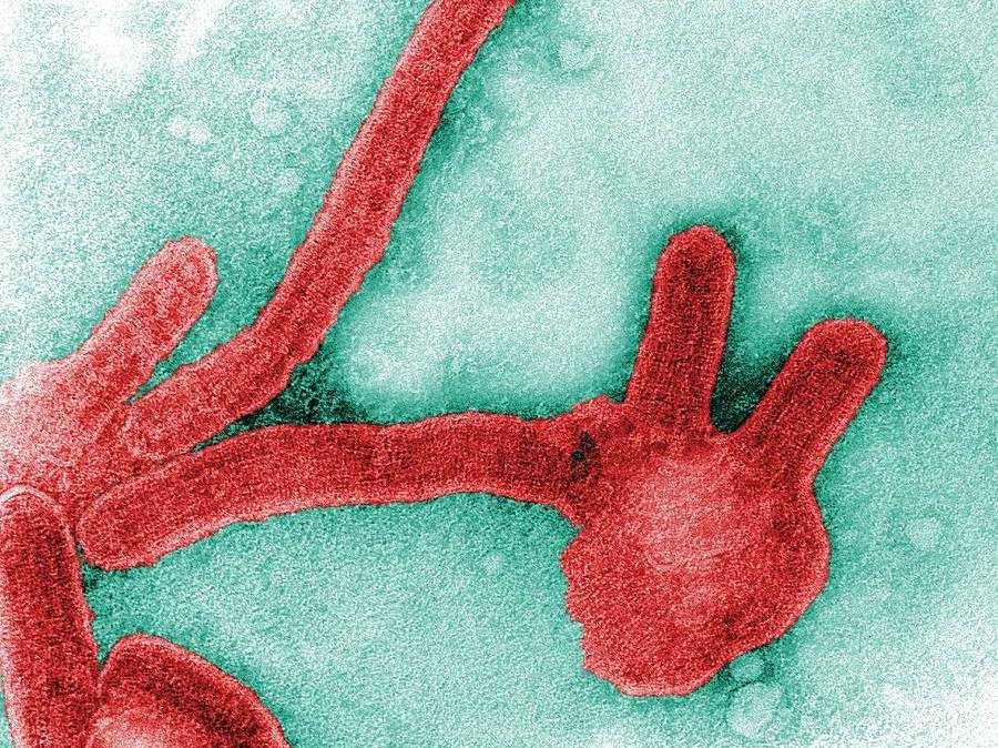 Vírus de Marburg, semelhante ao ebola, identificado em paciente morto no Guiné