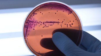 Aumento no número de bactérias resistentes coloca em risco a saúde de humanos e de animais em todo o mundo