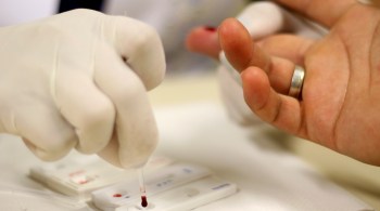 Sobrecarga no sistema de saúde provocado pela pandemia derrubou o número de diagnóstico de infecção pelo HIV no Brasil, dizem especialistas ouvidos pela CNN