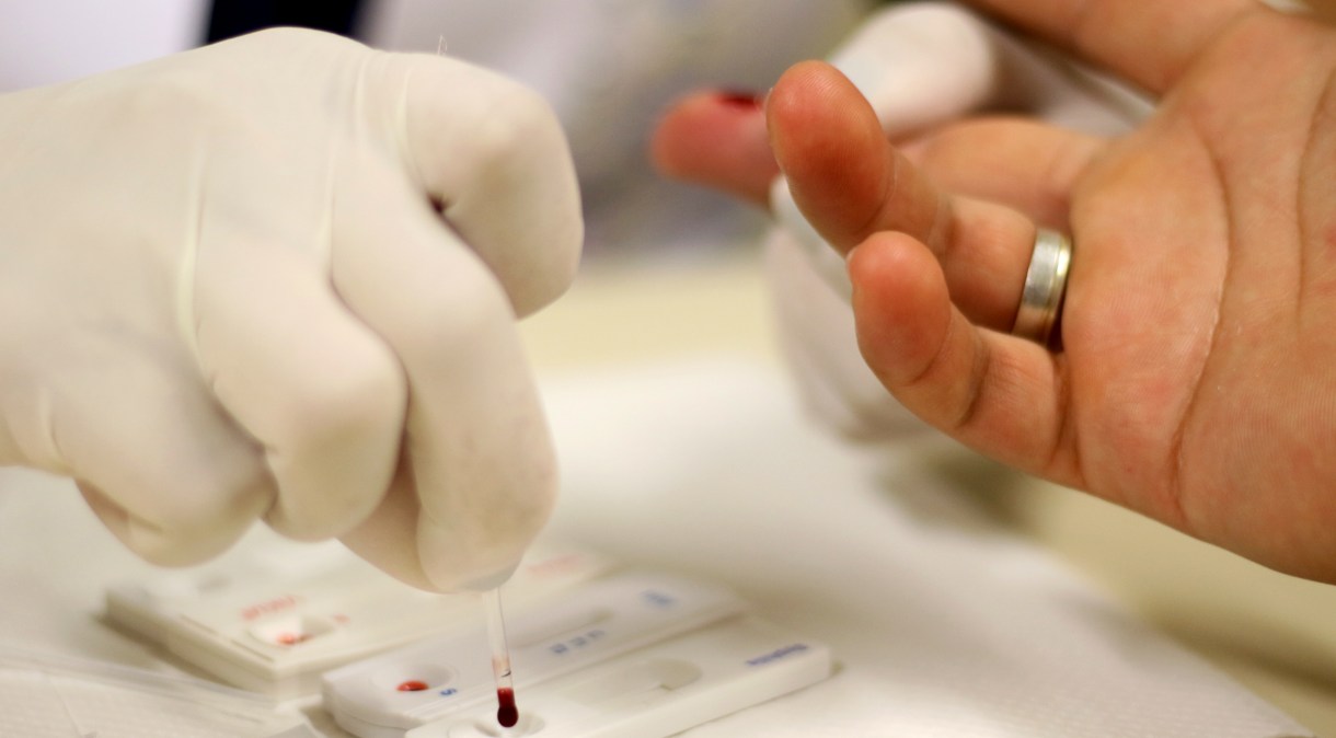 Teste para identificação do HIV