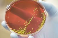 Conheça os principais riscos relacionados à infecção por Salmonella