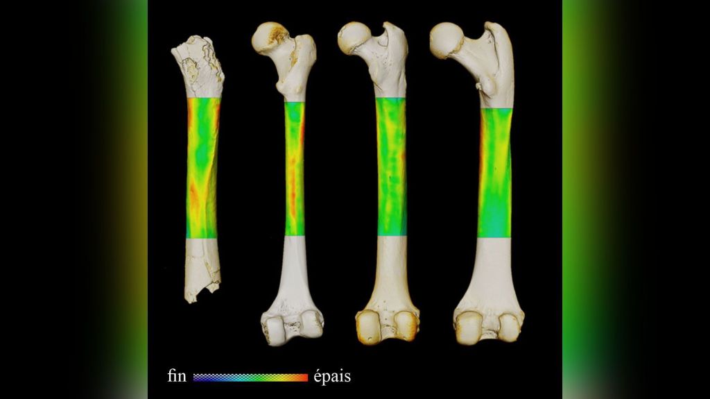 Esta imagem mostra o mapa de variação de espessura para os fêmures de (da esquerda para a direita) Sahelanthropus, um humano existente, um chimpanzé e um gorila (em vista posterior)