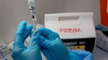 À CNN Rádio, Flavio da Fonseca afirmou que a mpox não tem potencial para se transformar em uma pandemia