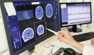 Doenças neurodegenerativas: o que são, sinais de alerta e como diagnosticar