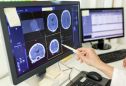 Doenças neurodegenerativas: o que são, sinais de alerta e como diagnosticar