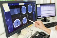 Doenças neurodegenerativas: o que são, sinais de alerta e como diagnosticar