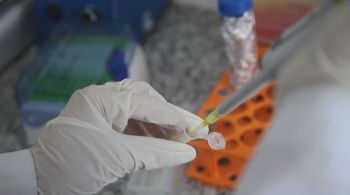 Embora as novas infecções por HIV tenham diminuído drasticamente desde o seu pico, na década de 1990, 39 milhões de pessoas vivem atualmente com a infecção