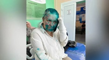 Imagens publicadas mostraram Milashina, cuja cabeça parecia ter sido raspada, coberta por uma substância verde e com bandagens em ambas as mãos
