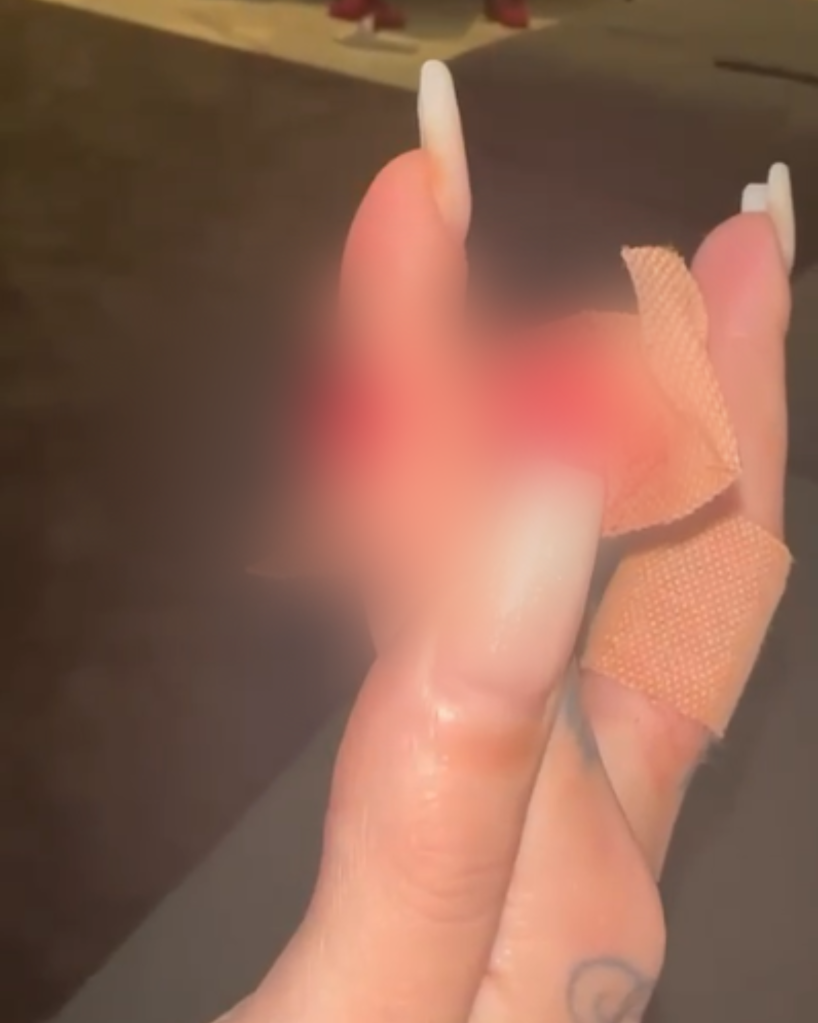 Foto mostra o corte em dedo da ex-namorada de Antony