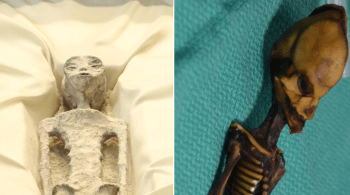 Em 2003, esqueleto encontrado no Chile foi tido como possível forma de vida extraterrestre; 15 anos depois, ficou provado que eram restos humanos