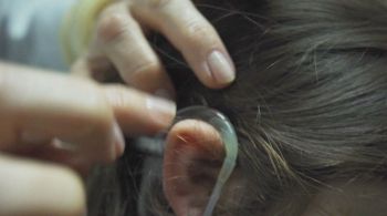 Roberto Kalil explica como funciona o implante coclear, o chamado “ouvido biônico”, cirurgia que implanta um aparelho eletrônico que substitui a função do ouvido interno nas pessoas que têm surdez total ou quase total