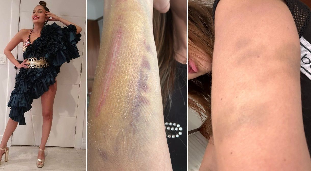 Ex-BBB Maria Melilo afirmou ter sido agredida com socos e chutes, após uma briga entre o casal