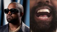 Kanye West coloca prótese de titânio nos dentes avaliada em R$ 4 milhões