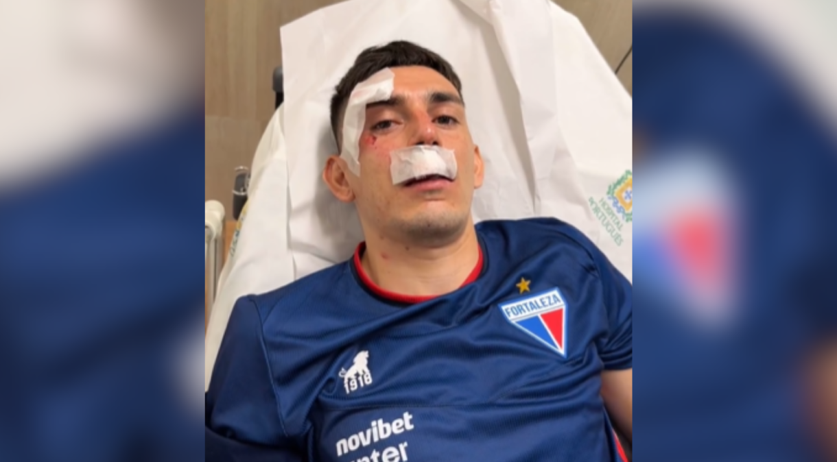 Jogador Gonzalo Escobar hospitalizado após ônibus do Fortaleza ser atacado com bombas