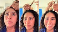 Hair Popping: puxar o cabelo para aliviar a dor de cabeça traz riscos à saúde