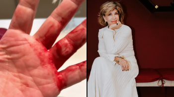 Nas redes sociais, a jornalista divulgou imagens com as mãos machucadas; caso aconteceu perto da casa da vítima