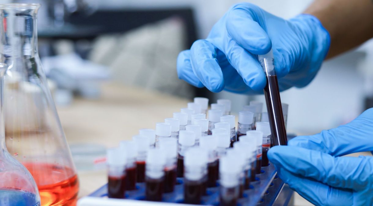 Exame de sangue com IA pode ajudar a detectar precocemente nove tipos de câncer