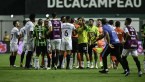 Juninho responde se faltou "fair play" ao América em lance de gol contra o Santos