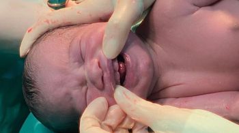O caso foi divulgado nas redes sociais da obstetra responsável pelo parto