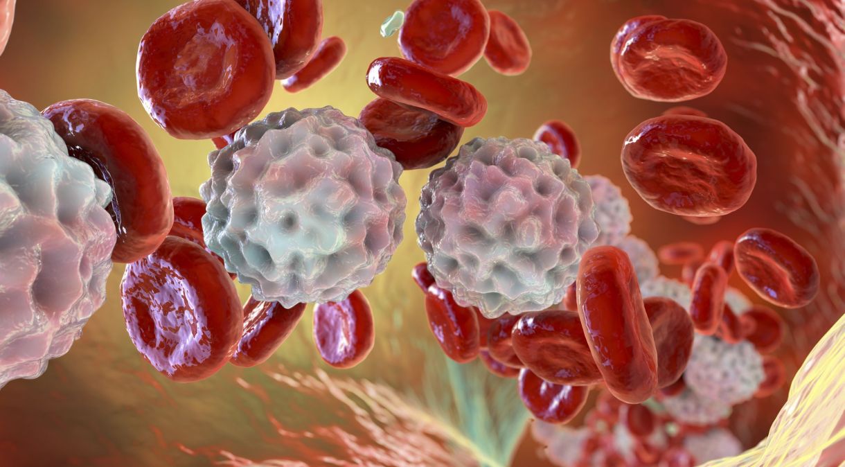 Na LLC, os linfócitos (glóbulos brancos) se tornam cancerosos e, de forma lenta e progressiva, substituem as células saudáveis nos linfonodos