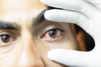 Novo método de terapia fotodinâmica pode erradicar o melanoma ocular, diz estudo