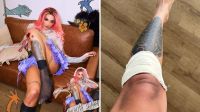 Pabllo Vittar mostra machucados após show de Karol G