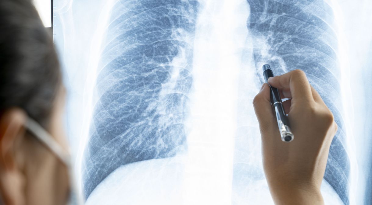 Médica analisa exame de Raio X de pulmão