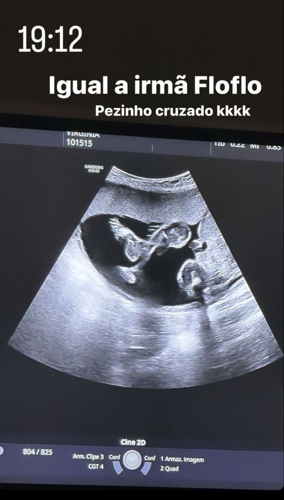 Virginia mostra imagens de bebê em novo ultrassom