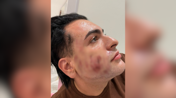 Henrique Chagas, de 27 anos, foi encontrado sem vida após ter realizado procedimento estético para aliviar marcas de acne