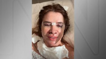 Viviane Di Felice apareceu nas redes sociais com hematomas e cortes no rosto causados pelo procedimento