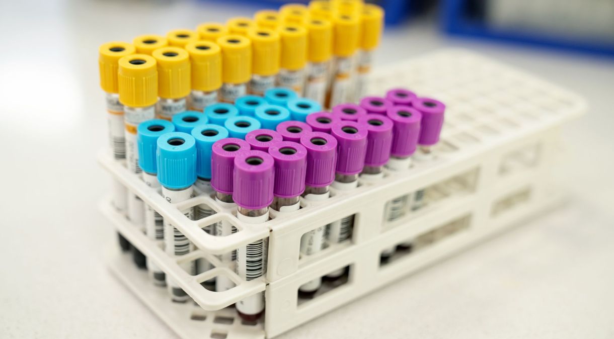 O exame de PCR é feito a partir da coleta de amostra de sangue e pode ajudar no diagnóstico de doenças infecciosas e processos inflamatórios