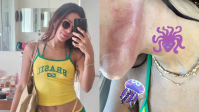 Anitta é queimada por água-viva em Ibiza: &quot;Dor que nunca senti na vida&quot;