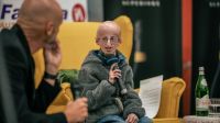 O que é progeria? Doença do envelhecimento precoce faz crianças parecerem idosos