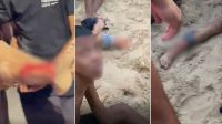 Vídeo: banhistas são atacados por cardume de peixe-espada no RJ