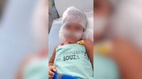 Menina de 2 anos que foi baleada na cabeça recebe alta no RJ